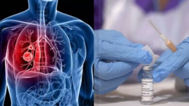 Photo of फेफड़े के स्मॉल सेल कैंसर में क्रांतिकारी खोज: ऐसे इलाज से मिलेगा फायदा